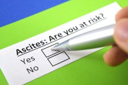 Асцит при циррозе печени: почему возникает и как лечить