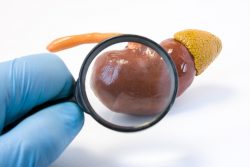 Острый тубулоинтерстициальный нефрит: симптомы и лечение