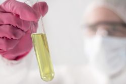 Проба Реберга: показания, как правильно сдавать, расшифровка