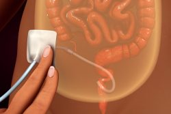 Перитонеальный диализ: что это, показания, противопоказания, методика проведения