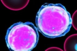 Хронический миелолейкоз: симптомы, картина крови, лечение