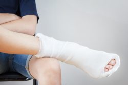 Виды гипсовых повязок, правила наложения