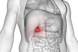 Рак желчного пузыря: первые симптомы, принципы диагностики и лечения