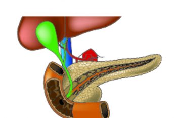 Аберрантная поджелудочная железа, ее лечение