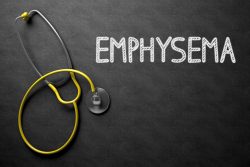 Эмфизема легких: что это такое, симптомы, лечение