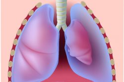 Коллапсотерапия при туберкулезе: цели, методика, противопоказания