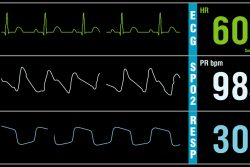 Тахипноэ: что это такое, симптомы, как лечить