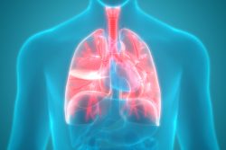 Легочная гипертензия: симптомы, как лечить