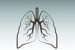 Туберкулез бронхов: особенности течения, принципы лечения