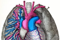 Артериовенозная аневризма легких: особенности течения, принципы лечения