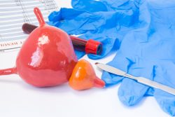 Дивертикул мочевого пузыря: симптомы, лечение