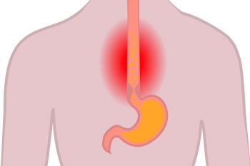 Ожог глотки и пищевода: симптомы, неотложная помощь, лечение