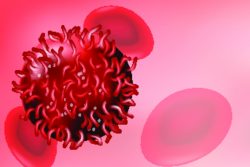 Злокачественная гемангиоперицитома: чем проявляется и как лечить