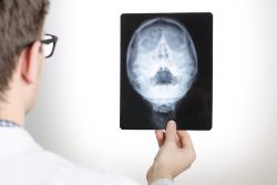 Фронтит: что это такое, особенности течения и лечения