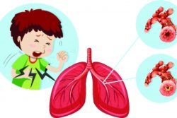 Бронхообструктивный синдром у детей: почему возникает и как проявляется