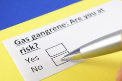 Газовая гангрена: возбудитель, симптомы, лечение