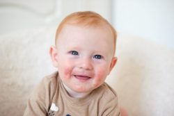 Аллергия у детей: секреты лечения