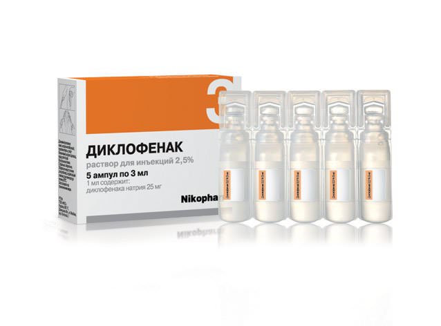 фибромиалгия диагностика и лечение