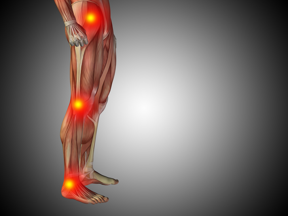 Фибромиалгия: причины и симптомы