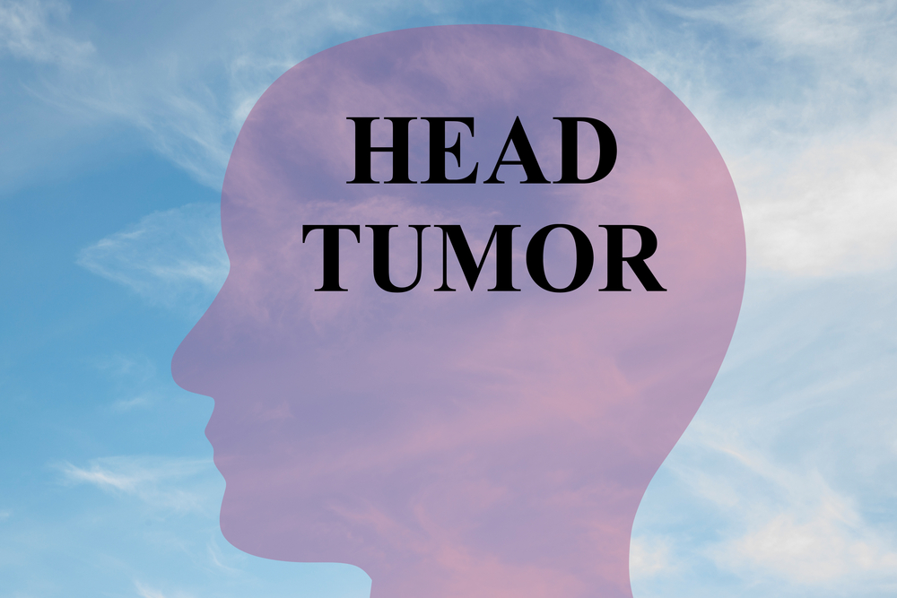 Признаки опухоли головного мозга