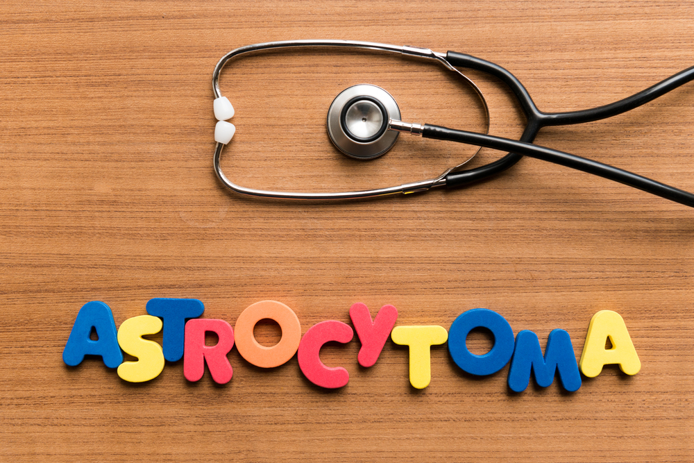 Астроцитома головного мозга: причины, симптомы, лечение, прогноз