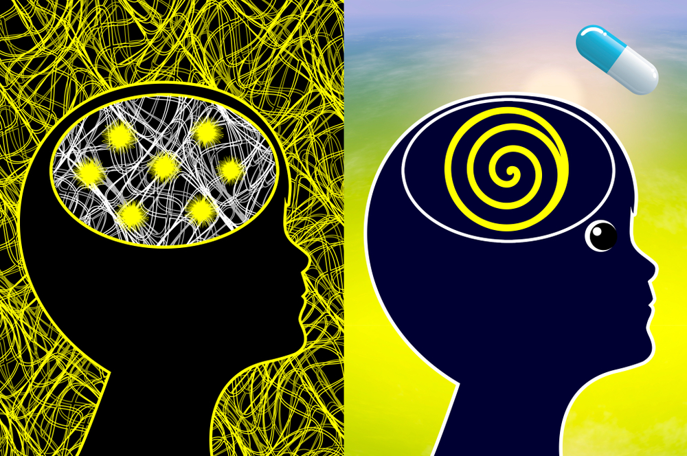 Приступы эпилепсии: причины, лечение