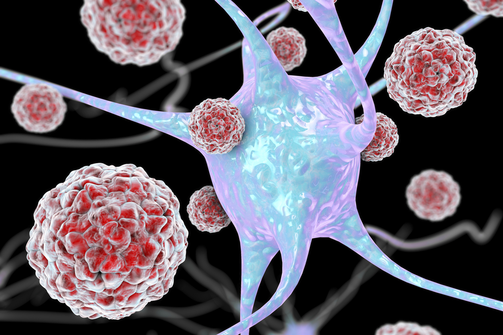 Герпетический энцефалит: симптомы и лечение