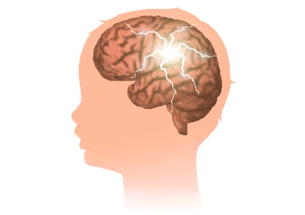 Эпилепсия: симптомы у детей