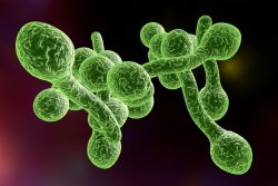 Фарингомикоз: симптомы и лечение