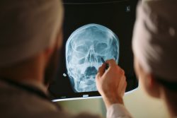 Как зубные инфекции провоцируют гайморит и синусит: скрытая угроза