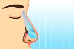 Риносклерома: признаки, принципы лечения