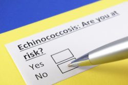 Эхинококкоз легких: причины, симптомы и лечение
